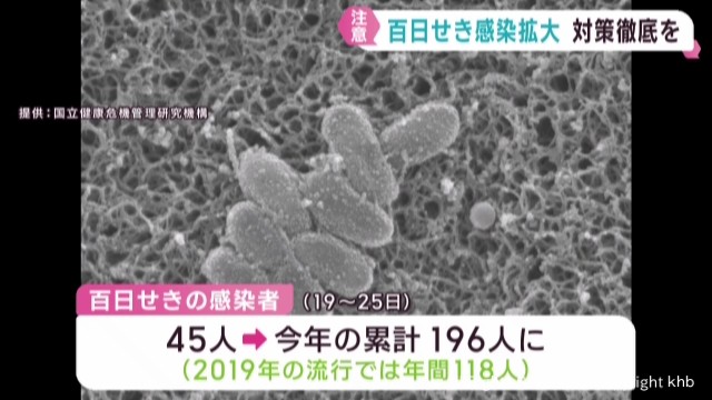 百日せきの感染者数 宮城県は過去最多ペースで増加 感染対策徹底を（khb東日本放送） - Yahoo!ニュース - Yahoo!ニュース