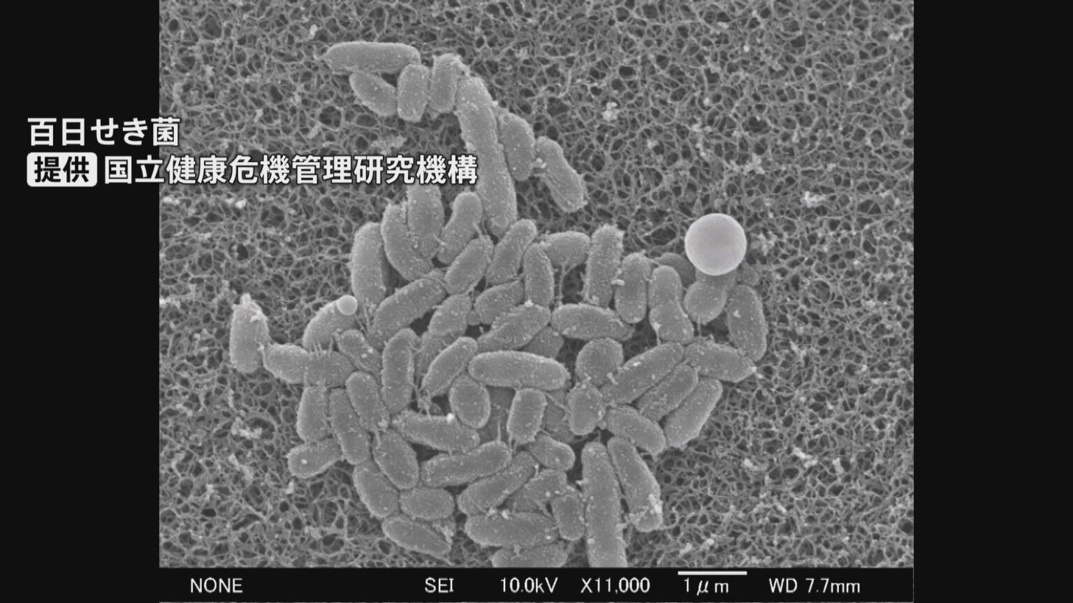 百日咳が県内で過去最多 小学校高学年から中学生を中心に拡大 県は早期の医療機関受診を呼びかけ 富山（チューリップテレビ） - Yahoo!ニュース - Yahoo!ニュース
