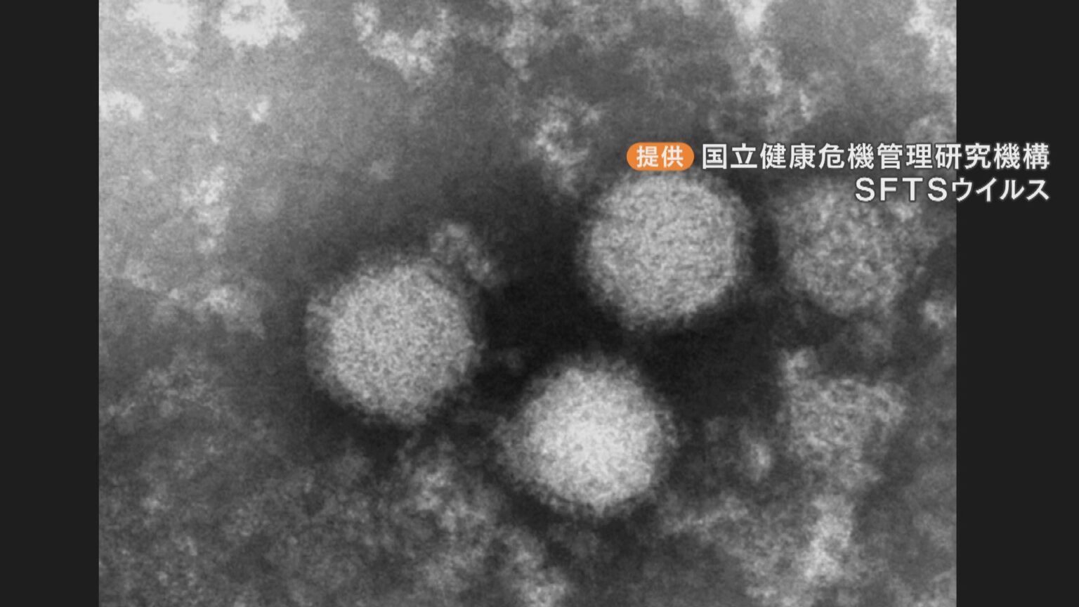 マダニ感染症「SFTS」広がる 愛知で2人死亡 草むらで除草作業した50代女性も 豊田市（CBCテレビ） - Yahoo!ニュース