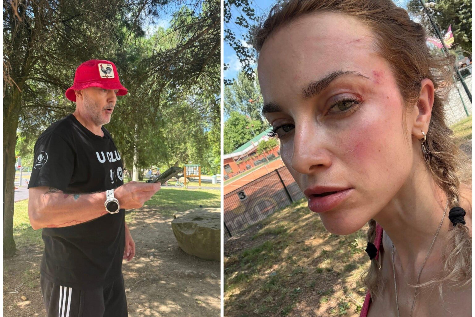 女性は公園でファンu Clujに打たれました：「彼は私がウクライナ人であり、私にはここにいる権利がないと言った」