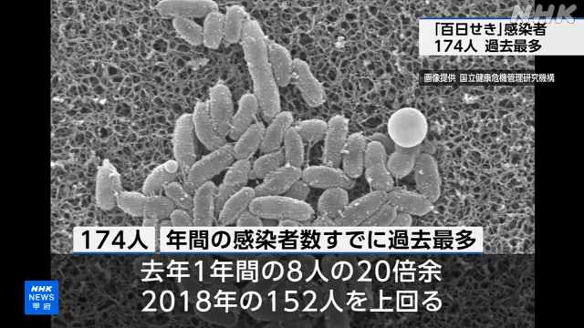 山梨 「百日せき」 年間の感染者数すでに過去最多を更新|NHK 山梨県のニュース 山梨 「百日せき」 年間の感染者数すでに過去最多を更新|NHK 山梨県のニュース