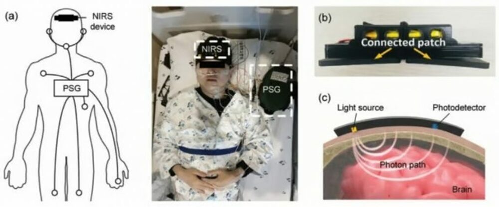 睡眠中に働く「脳の清掃システム」リアルタイム測定…韓国の研究チーム「認知症克服」のカギとなるか　写真枚　国際ニュース：AFPBB News