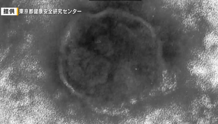 「はしか」感染者を確認 広島県内では６年ぶり 広島市の30代男性 渡航先ベトナムで感染か（テレビ新広島） - Yahoo!ニュース - Yahoo!ニュース