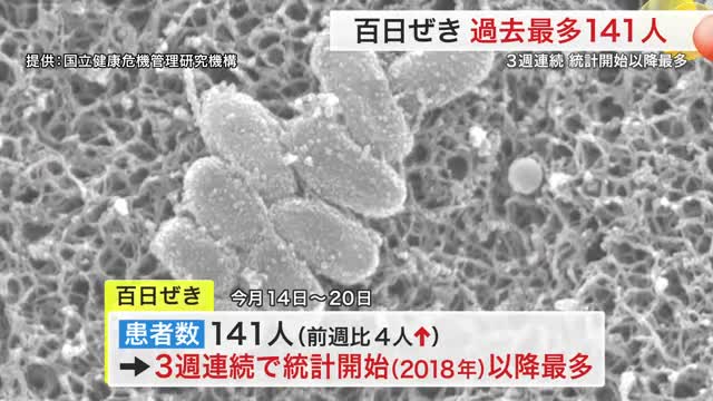 宮城県内で百日ぜき急拡大 過去最多の１４１人に １４歳までの子供が８割以上 県が対策呼びかけ（仙台放送） - Yahoo!ニュース - Yahoo!ニュース