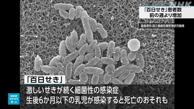 「百日せき」 県内の患者数が再び増加 累計４００人に｜NHK 富山県のニュース