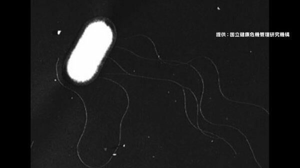 O157に感染 横浜で70代女性が死亡 市内死亡例は2019年以来