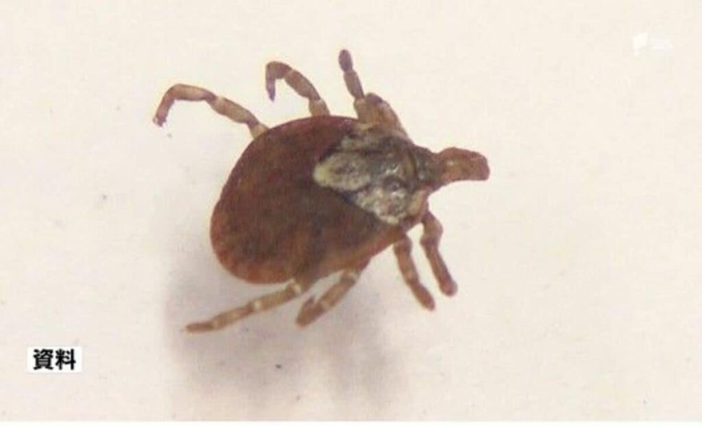 マダニ媒介「日本紅斑熱」患者2025年14人目確認、過去最多発生数に並ぶ SFTSは4人目、感染の男性死亡＝静岡県