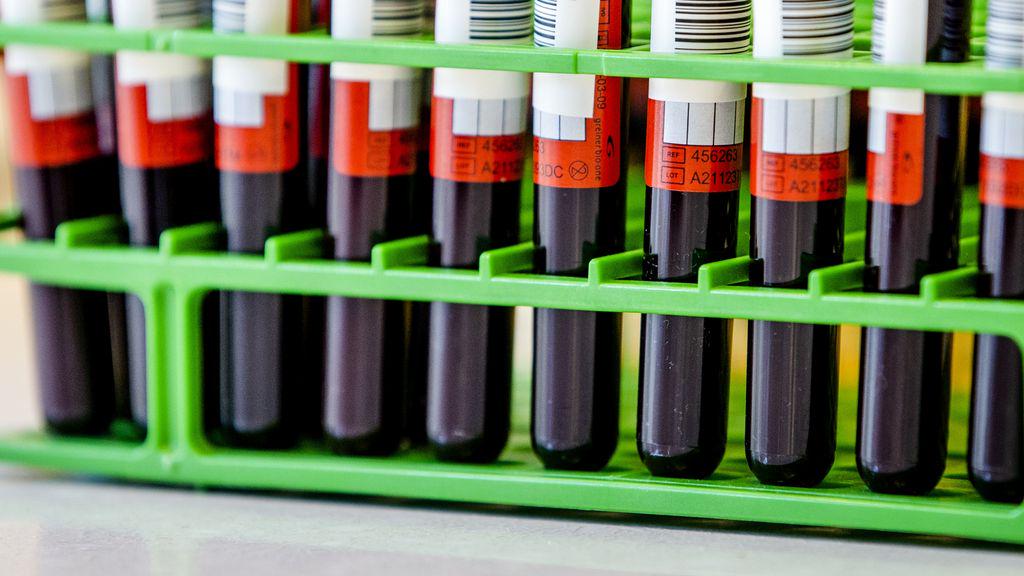 RIVM：オランダの誰もが血液中のPFAを持っています