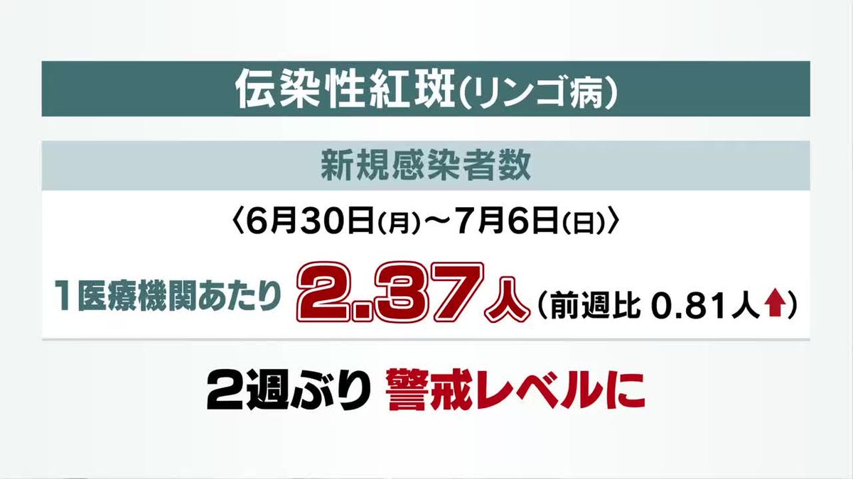 「リンゴ病」2週ぶり警報レベル　岩手県