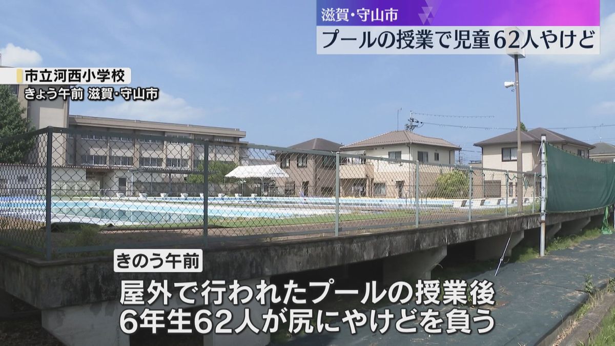 小学校のプールの授業で児童62人やけど　プールサイドのマットに座っていた間か　気温は35.9℃　滋賀・守山市