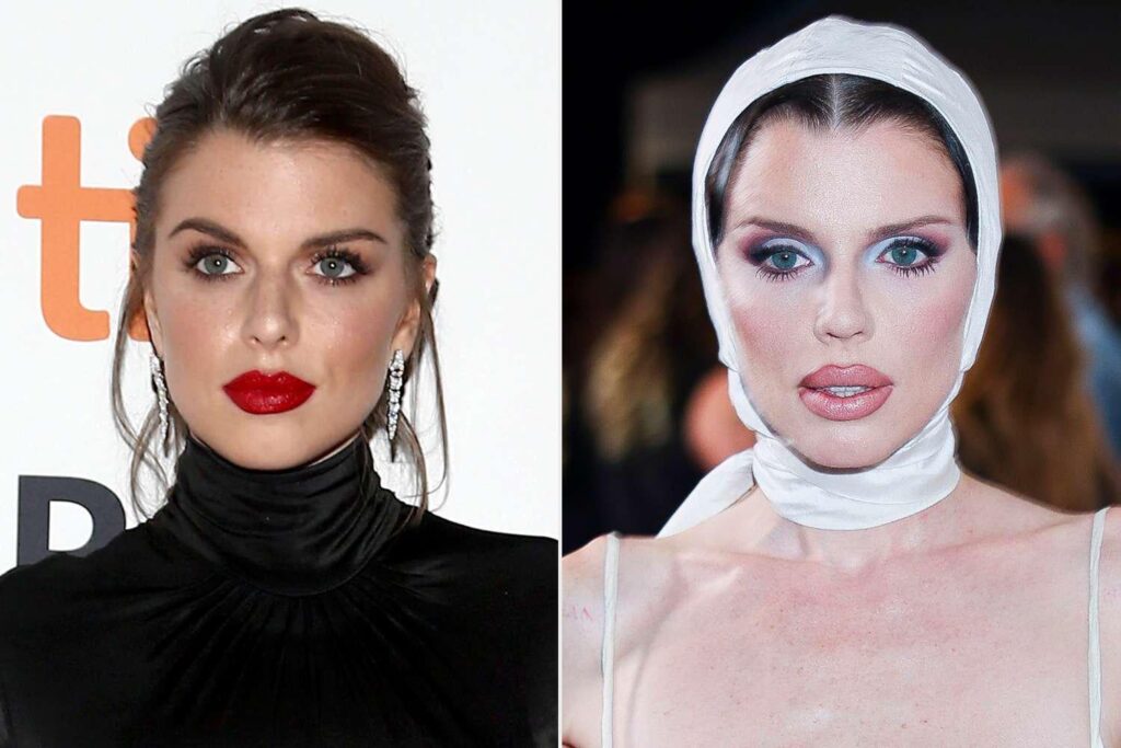 ジュリア・フォックスは、男性にアピールするために美容整形手術を受けたことを後悔しています：「私は戻ってきたらいいのに」