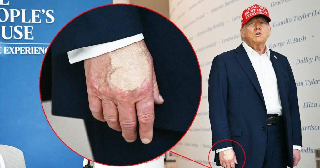 トランプ、79、カンクルの隠蔽の中でメイクアップの右手を塗る