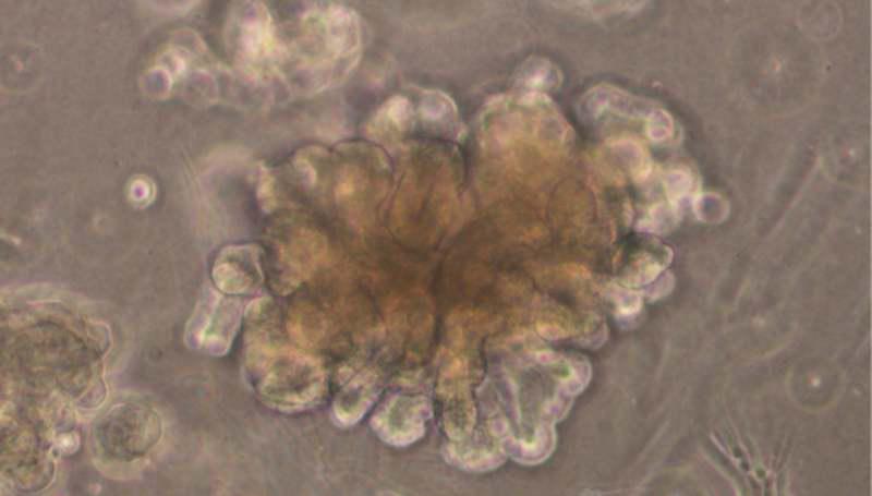 科学者たちが初めて純粋で安定したヒトのミニ腎臓を培養。この画期的な成果は、腎臓病の理解を深め、新しい治療法の開発、さらには将来的な移植の実現にも役立つ可能性があります。