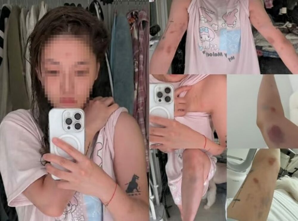 「一晩一緒に」誘い断ると暴行…台湾女性が韓国で受けた屈辱　写真枚　国際ニュース：AFPBB News