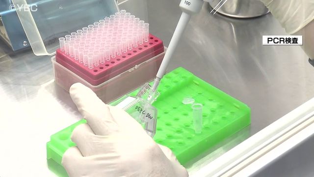 山形県内の新型コロナウイルス感染者数 7週ぶりに減少 低い年齢層に多い傾向（YBC山形放送） - Yahoo!ニュース - Yahoo!ニュース