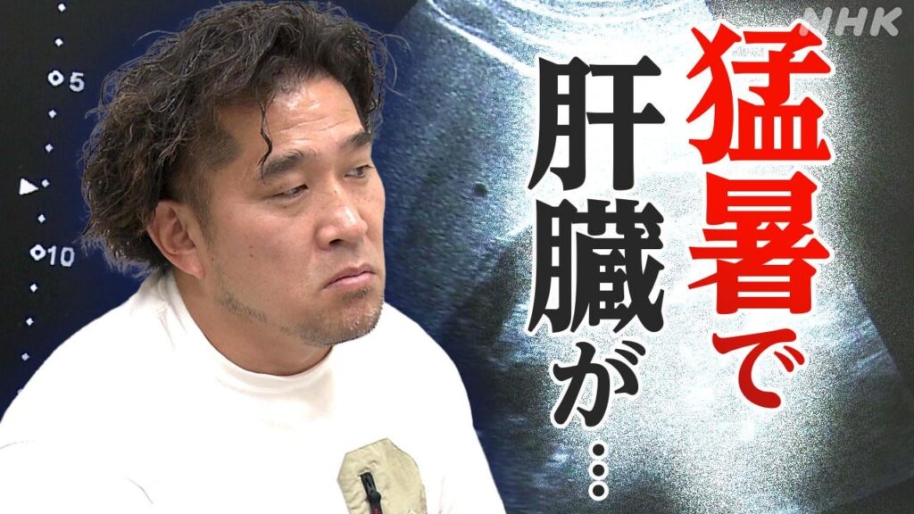 熱中症対策の落とし穴 肝臓があぶない？ 7つの食材で対策を