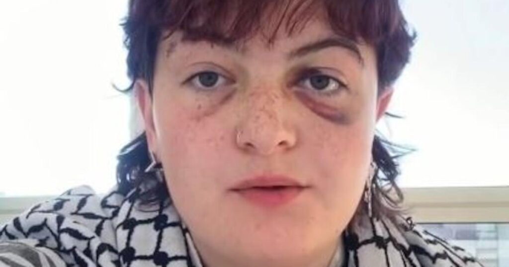 アイルランドの抗議者キティ・オブライエンは、ベルリン警察が広範囲にわたる暴力を非難している