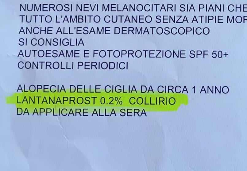 イタリアの健康：博士は私にアセトンを点眼薬として処方します