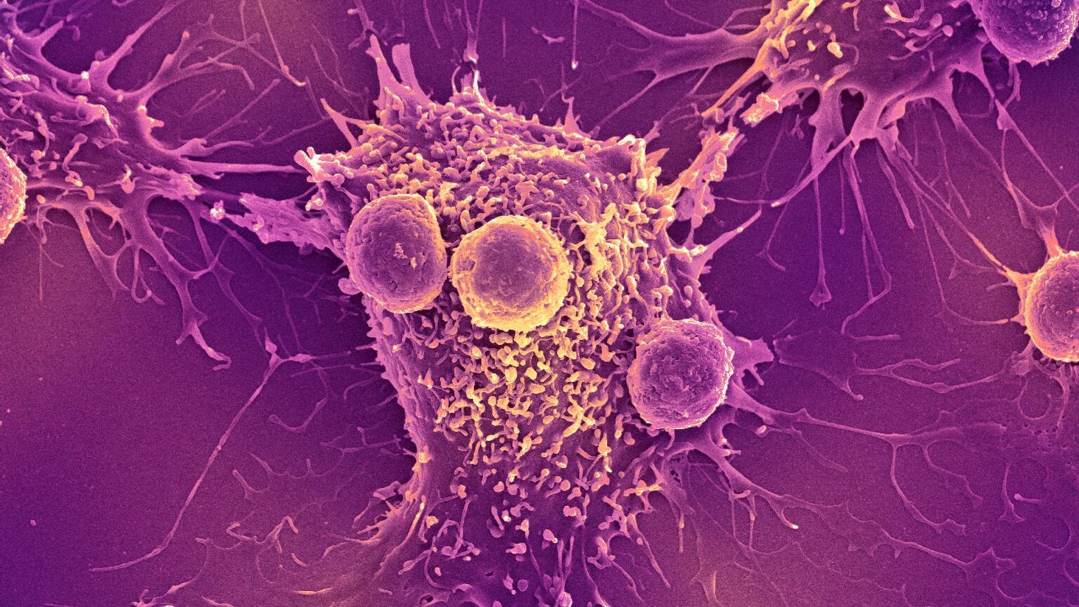 新型コロナウイルス感染症（COVID-19）mRNAワクチンは、免疫系にがんを認識させて殺す可能性があることが研究で判明