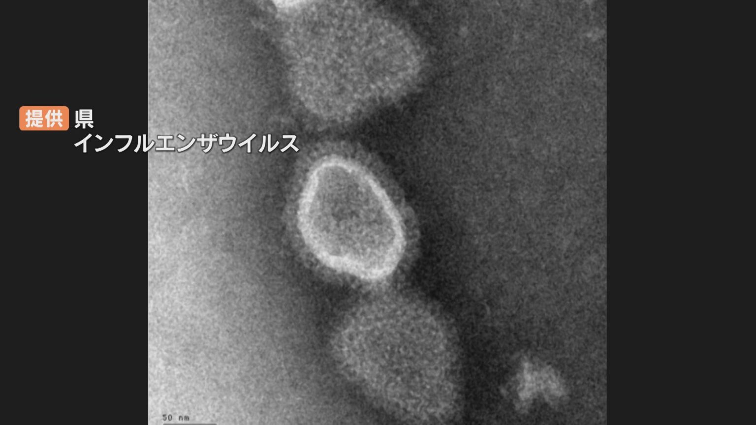 インフルエンザ患者増加 流行期入りの目安を早くも超える 県「局所的な流行か見極めたい」大分（OBS大分放送） - Yahoo!ニュース - Yahoo!ニュース