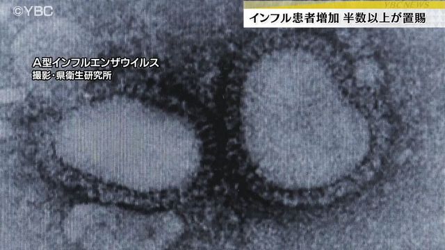 山形県内でインフルエンザ患者が増加 置賜保健所管内に患者の半数以上が集中（YBC山形放送） - Yahoo!ニュース - Yahoo!ニュース