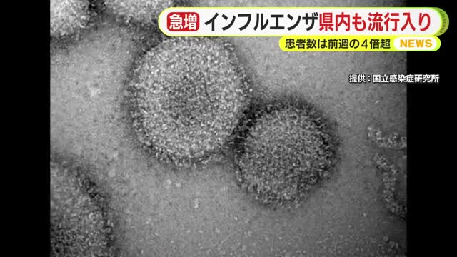患者数は前週の4倍超に…インフルエンザが静岡県内も流行入り（テレビ静岡NEWS） - Yahoo!ニュース - Yahoo!ニュース