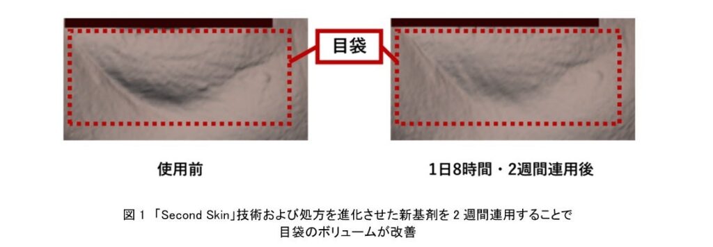 資生堂、進化した「Second Skin」技術により目袋のボリュームを改善する新基剤を開発　～新たな作用メカニズムも解明、収縮膜による微弱な圧縮刺激が皮ふ内部に作用～ | 株式会社資生堂のプレスリリース