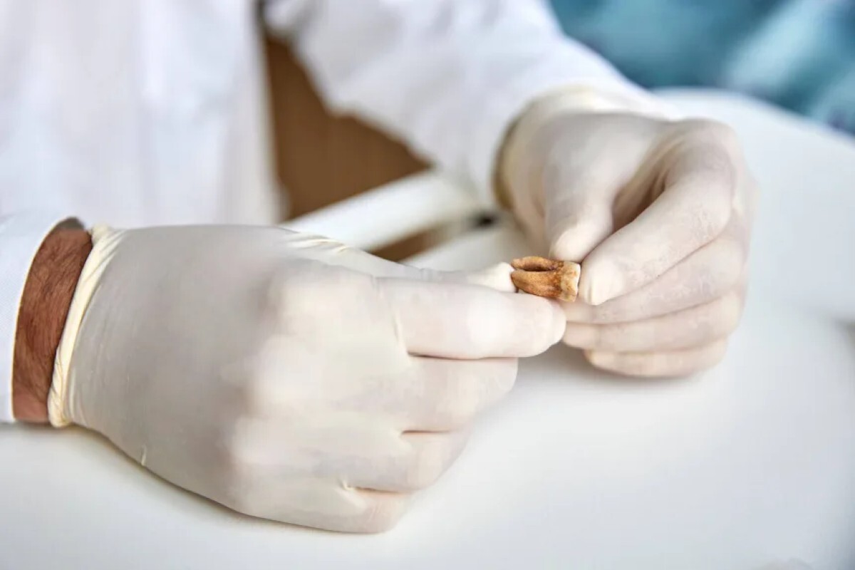 研究者は今回、リトアニア首都ビリニュスで2001年に発見された集団墓地から見つかった兵士の歯を分析した/Claudio Centonze/European Commission