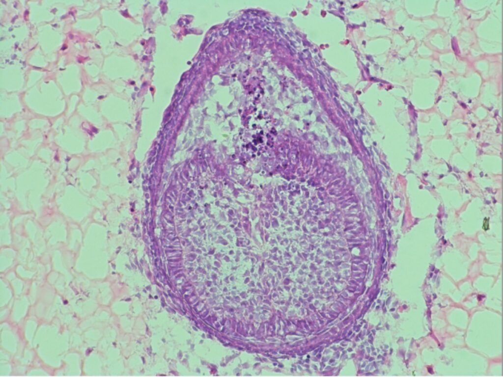 ヒトの歯を培養する研究、実用化に向け前進 - CNN.co.jp