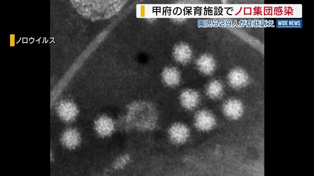 保育施設でノロ集団感染 園児ら29人が症状訴え 県内での集団感染は今季初 山梨・甲府市（YBS山梨放送） - Yahoo!ニュース