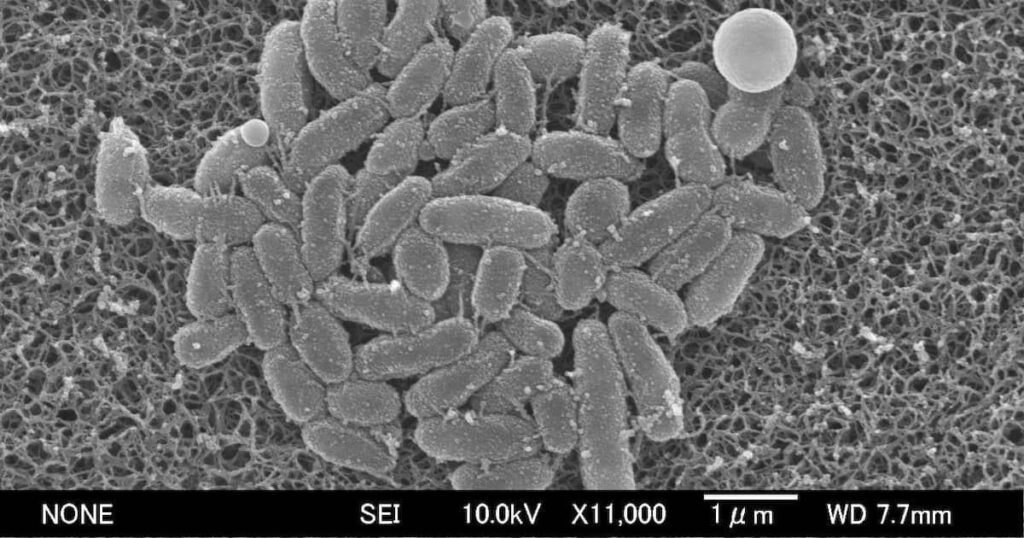 百日ぜき、薬剤「耐性菌」が8割 遺伝子型は中国で昨年流行の型に近似、訪日客で拡大か