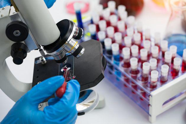 アイルランドは発見が遅れるとの懸念があり、昨年のHIV診断率はEU内で2番目に高かった。