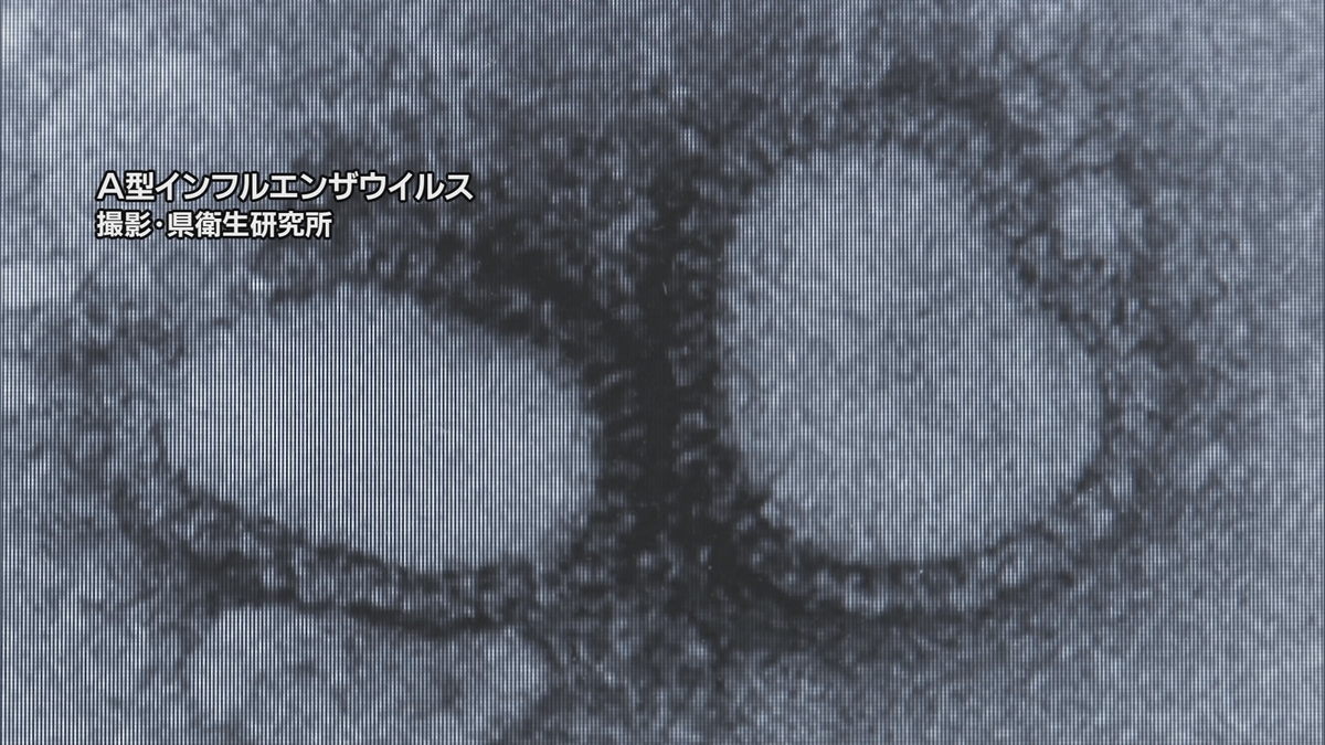 山形県内でインフルエンザの患者数が警報レベルに　流行の始まりから過去最短で感染急拡大