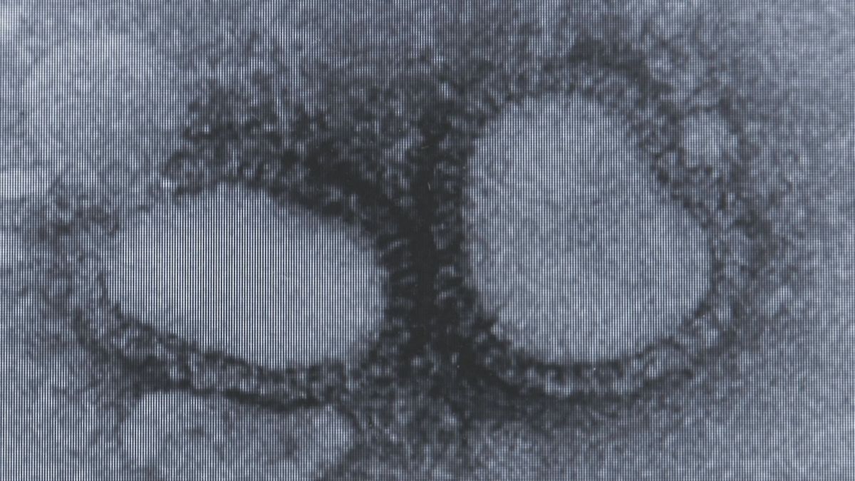 山形県内のインフルエンザ患者数が急速に拡大　注意報レベルに　昨シーズンより1か月早いペース
