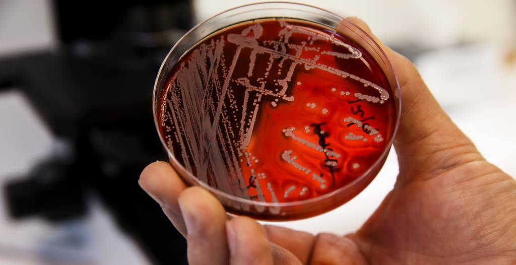研究者: もうすぐ抗生物質は効かなくなるでしょう