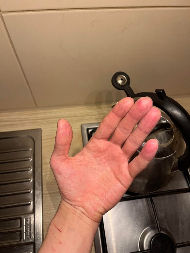 皮膚の問題
