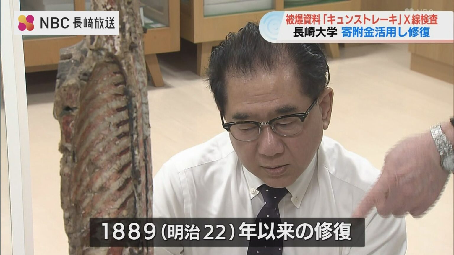 長崎大学 紙製人体解剖模型「キュンストレーキ」保存に向けX線検査（NBC長崎放送） - Yahoo!ニュース