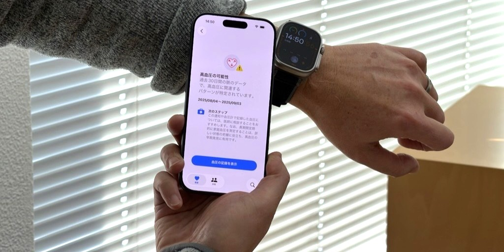 Apple Watchで「高血圧の可能性」が検出可能に：日経メディカル