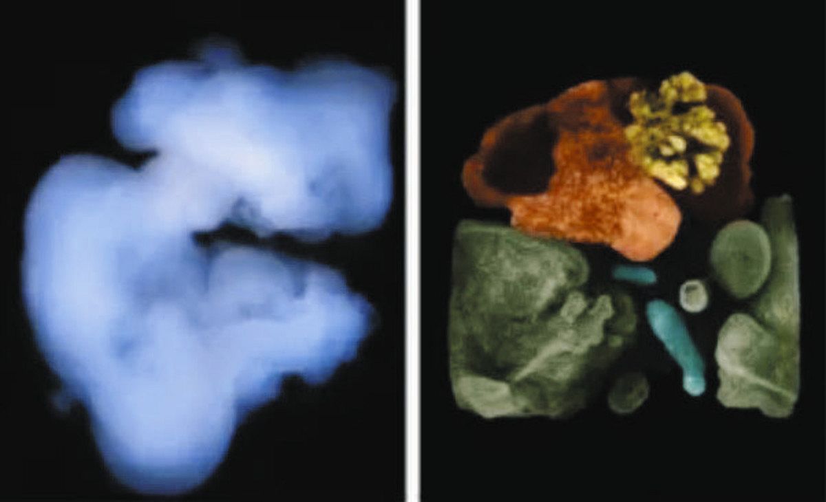 培養により形成されたミニ多臓器。左は顕微鏡写真。右は各臓器を色分けした写真で、肝臓・胆管は赤と水色、膵臓は黄色、腸は緑色＝シンシナティ小児病院提供
