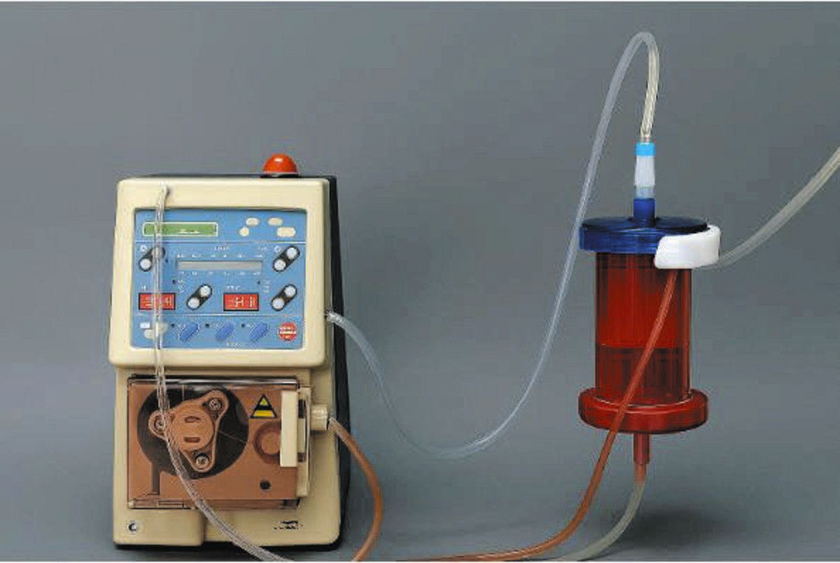 肝臓オルガノイドを用いた体外循環装置＝大阪大・東京科学大提供
