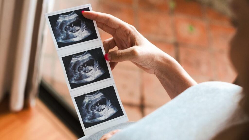 奇形児は「わずか」15％のため、いとことの結婚を支持するようNHSが助産師に指示に激怒