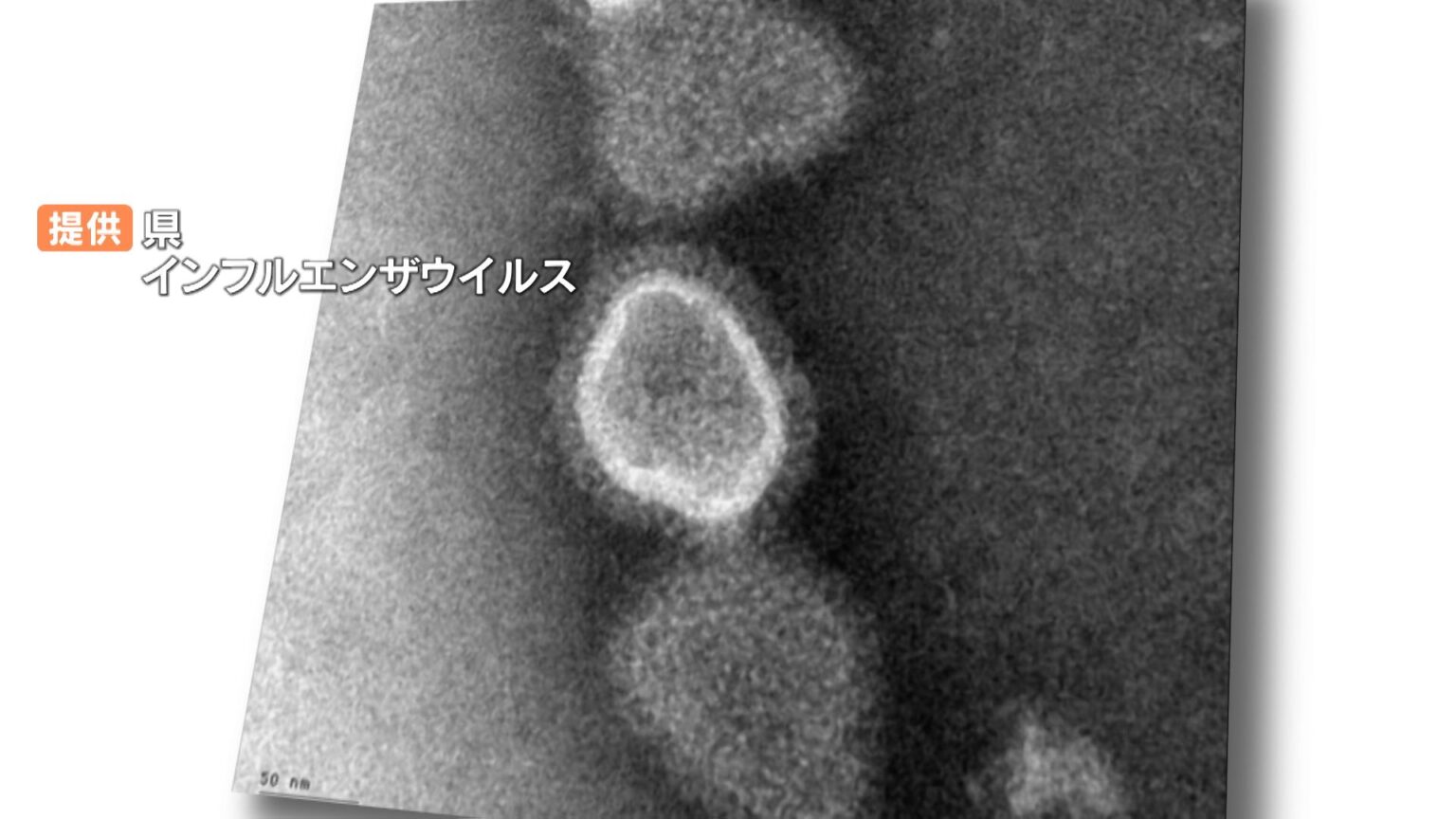 インフルエンザ患者数 大分県で4週連続増加　1医療機関あたり「69.67人」今季最多（OBS大分放送） - Yahoo!ニュース