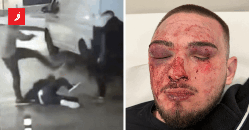 リエカで16歳の少年が殴られ、蹴られたり、引きずられたり… 父親: 理由もなく殴られた