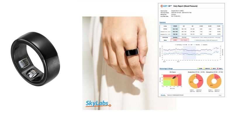 韓国スカイラボス社と指輪型自動血圧計の国内独占販売契約締結　大塚製薬 | 医薬通信社
