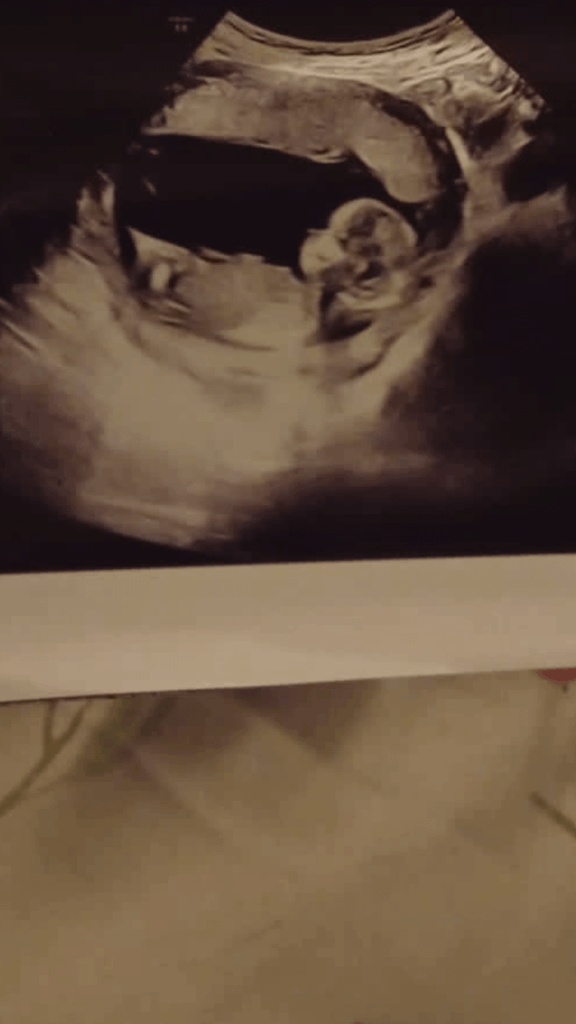 赤ちゃんだ！この経済では？