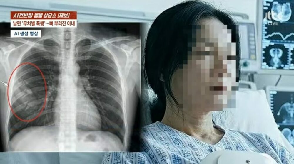 韓国で続いた家庭内暴力…「義父母の法事を忘れた」と夫が暴行、肋骨骨折の女性が離婚をためらう現実　写真枚　国際ニュース：AFPBB News