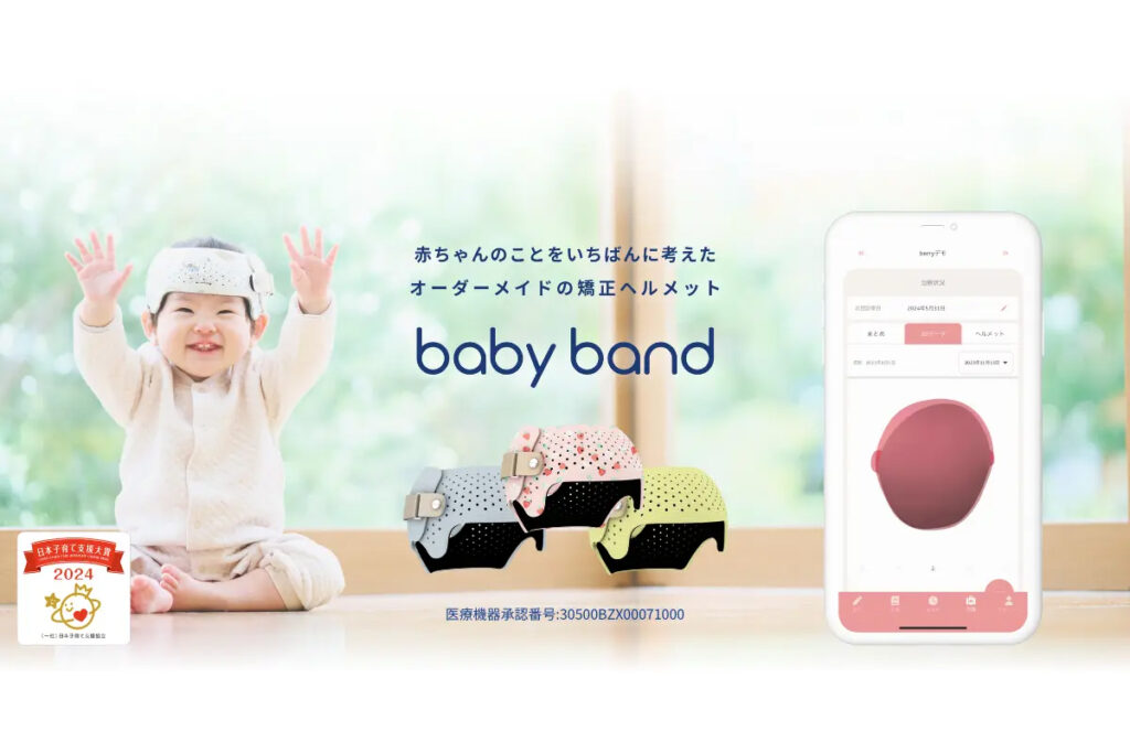 頭蓋形状矯正ヘルメット「ベビーバンド」、岡山・宮城で初導入 全国240施設超へ拡大 | 業務用3Dプリンターのポータルサイト ShareLab – ShareLab NEWS ShareLab 無料メルマガ登録はこちら