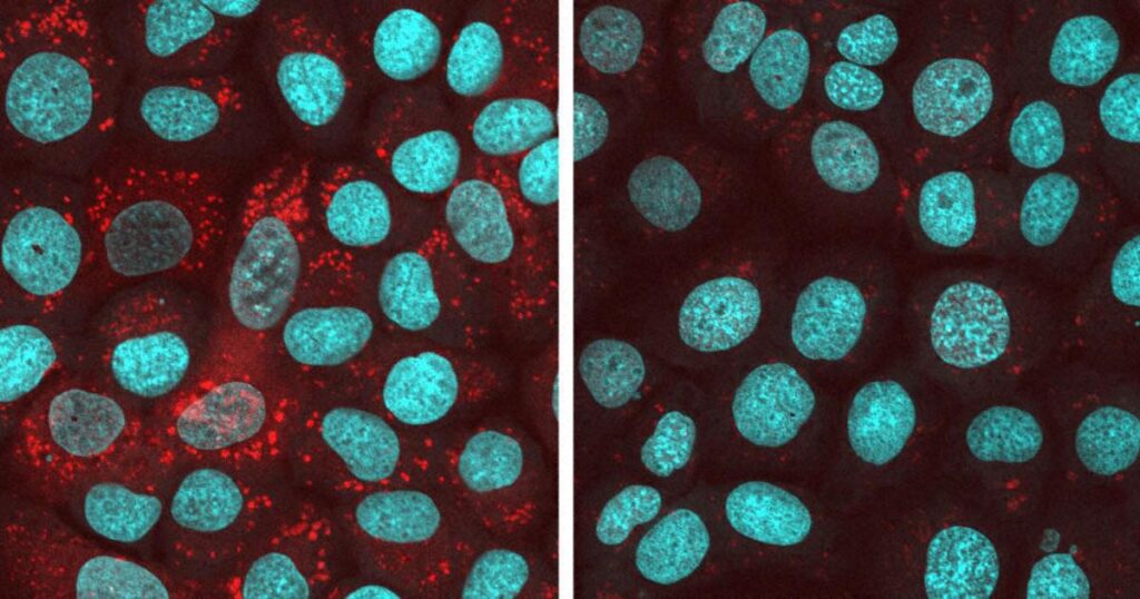 ALSの原因物質を制御する化合物発見 奈良県立医大や徳島大