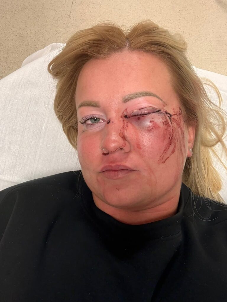 フィデスの副市長は私をめちゃくちゃに殴りました！