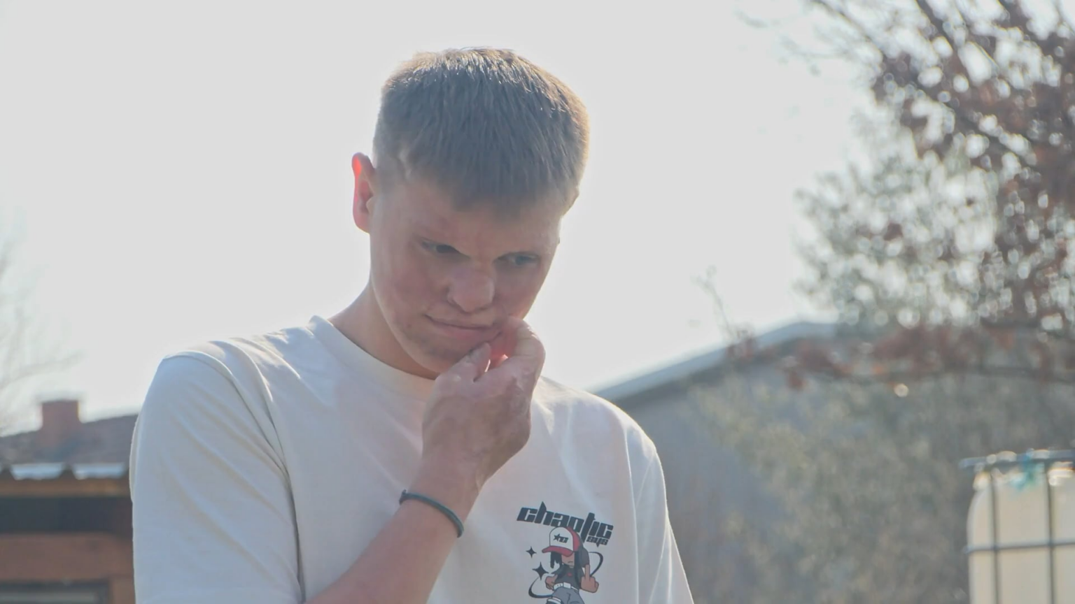 [Apel za pomoć] クリスチャンが新たなスタートを切り、傷のない顔になるチャンスを掴めるように手助けしましょう